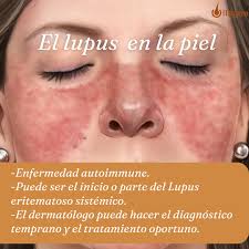 Centro de Dermatologia OLLAGUE (@dermatologosollague) • Instagram photos  and videos