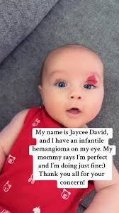 I've been asked by a lot of people what is “wrong” with my babies eye....