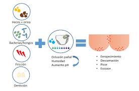 Dermatitis Del Panal Que Es Y Por Que Se Produce Faros Hsjbcn