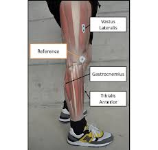 Anatomy and function of bones and muscles, plus diagram jun 18, 2018your legs are two of your most important body parts. Electrodes In White Placement For The Dominant Leg Muscles Sensing Download Scientific Diagram