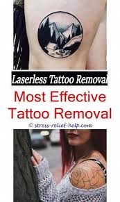 So Entfernen Sie Schwarze Finger Tatowierung Wie Tatowierungs Laser Entfernungsarbeit Wie Teuer Entfernen Entfernung Tatowierungen Haut Laser Entfernung