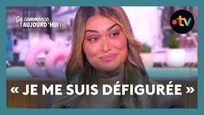 Ma chirurgie Maxillo-faciale