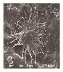 Image result for Phragmanthera capitata