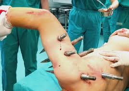 They never do show you. Factory Robot Impales Worker With 10 Foot Long Steel Spikes After Horror Malfunction