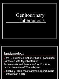 Image result for Genitourinary Tuberculosis