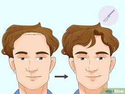 We did not find results for: 10 Ways To Fix A Receding Hairline Wikihow