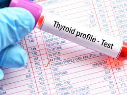 This means that the thyroid is not producing enough thyroid hormone for the body's needs. Thyroid Function Test Know What T3 T4 And Tsh Mean Times Of India