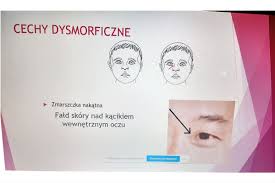 Soome, inglise, rootsi ja palju teisi keeli! I Lo W Swidniku Genetyka Przyszloscia Medycyny