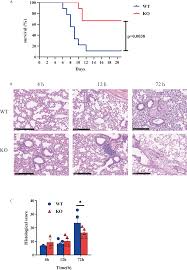Image result for Pulmonary Intoxicant
