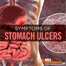 Can an ulcer cause pain anywhere in your stomach? Stomach Ulcers Causes Symptoms Home Remedies Treatment