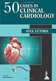 50 Cases In Clinical Cardiology Cardiology Cardiology Study Medical Textbooks