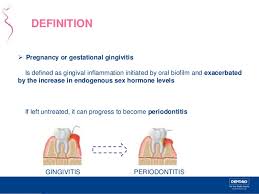 Gingivitis is an oral condition when the gums become inflamed and red due to bacterial infection, usually from plaque deposits. Periodontal Disease And Pregnancy