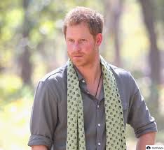 Prince Harry Hair Transplant