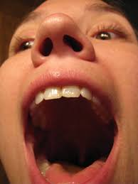 However, the more unique clinical feature of mono, which helps doctors to distinguish it from other viral and bacterial throat infections, is a severe and debilitating fatigue which accompanies these symptoms and may last for. Mononucleosis Aka Mono Finding Joy In Marriage