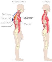 Pin On Health