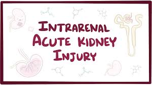 It's usually a result of a complication from another serious medical condition such as diabetes, high blood pressure or cardiovascular disease. Intra Renal Failure Examples Acute Kidney Injury A Guide To Diagnosis And Management