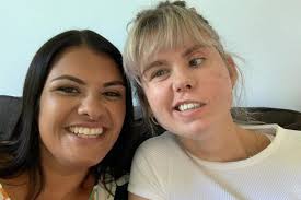 Zbog tumora joj je ostala polovina lica paralizovana