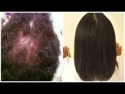 2 Faire Pousser Ses Cheveux Plus Vite Spray Activateur De Pousse Youtube Comment Faire Pousser Ses Cheveux Faire Pousser Les Cheveux Pousse Des Cheveux