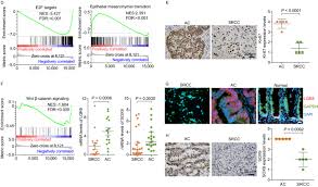 In addition, there are many officially. Frequent Rnf43 Mutation Contributes To Moderate Activation Of Wnt Signaling In Colorectal Signet Ring Cell Carcinoma Springerlink