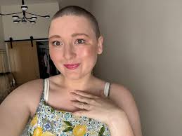 Alex's Story: It's okay to not be okay 👌