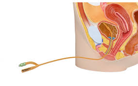 Image result for Urethral Catheterization