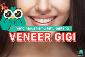 Veneer gigi hanya ada dua jenis, direct veneer dan indirect veneer. 7 Hal Yang Harus Kamu Pahami Tentang Veneer Gigi Hdmall