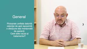 Ea este reprezentata prin acumularea excesiva la nivelul tesuturilor a unei cantitati mari de fluide, care din diverse motive nu mai poate fi eliminata in totalitate din organism. Picioare Umflate Si Retentie De Apa I Cauze Si Tratament I Dr Alin Popescu Www Sfaturimedicale Ro Youtube