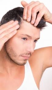 When you have hairline recession, your hair is receding for a reason. The 3 Components To Treating Hair Loss Help Hair Loss Treat Hair Loss Natural Hair Loss Treatment