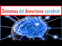 Los aneurismas cerebrales constituyen una patología de alto riesgo que puede determinar la muerte, déficit neurológico, deterioro de la calidad de vida, pérdida de la capacidad de productividad. Que Es El Aneurisma Cerebral Sintomas Causas Y Consecuencias De Un Aneurisma Intellectual