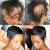 Best Hairstyles For Alopecia