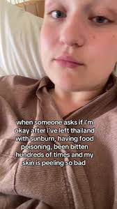 Sunburn to Tan in Thailand