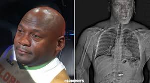 Somebody ate a diamond earring