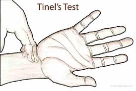 Image result for Carpal Compression Test