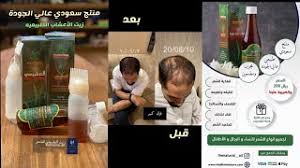 تجربة ياسا قبل وبعد لزيت الفاتن
