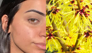 What Is Witch Hazel & How Can It Benefit Your Skin?