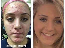 Dermatologist Created Skin + Hair Products