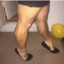 Girl With Huge Muscular Calves Muscular Women Calves Muscular