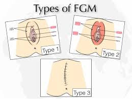 Eine kindeswohlgefährdung kann nach den vorgenannten ausführungen. Female Genital Multilation Fgm