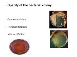 Colony Morphology Of Various Bacteria Laboratoryinfo Com