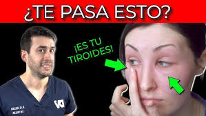 My experience taking FIT 9. Does it work? 🤔 #weightloss #slimming