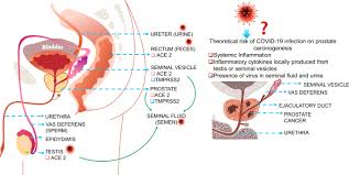 Based on a highly successful treatment of bph using pulsed electromagnetic field (pemf) therapy in dogs, the parsemus foundation supported a small clinical trial in men to see if the positive results translated to humans. Sex Differences In Sars Cov 2 Infection Rates And The Potential Link To Prostate Cancer Communications Biology