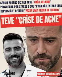 Sérgio Rosado ainda diz que ficou com marcas... SABE TUDO EM DIOGUINHO.COM