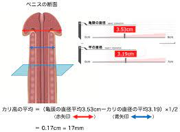 泌尿器専門医が解説】異物を入れずにカリ高ペニスを作る唯一の方法