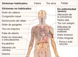 En caso de tener síntomas (fiebre o tos o dificultad respiratoria), sigue estos. Covid 19 Wikipedia La Enciclopedia Libre