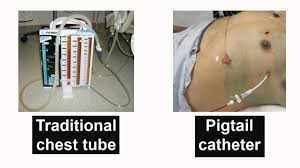 Image result for Chest Tube