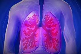 Pneumothorax Ursachen Symptome Diagnose Behandlung Hausmittel Krank De