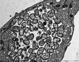 Aide pour les affections cutanées comme le psoriasis, l'eczema ou la séborrhée. Approches Diagnostiques Des Bacteries Intracellulaires Et Des Germes Fastidieux