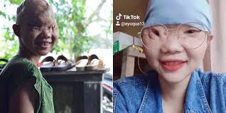 Hallo sobat bakra bertemu lagi dengan admin yang akan membahas foto una tiktok gemoy. Ayu Qua Tiktok Gadis Asal Palangkaraya Yang Tetap Pede Meski Fisik Gak Sempurna