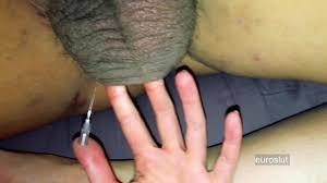 Boyfriends Testicles Get A Needle, Hot Extreme CBT Dirty Talk