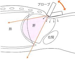Http Chtgkato3 Med Hokudai Ac Jp Lecture Abdominal Us Pdf